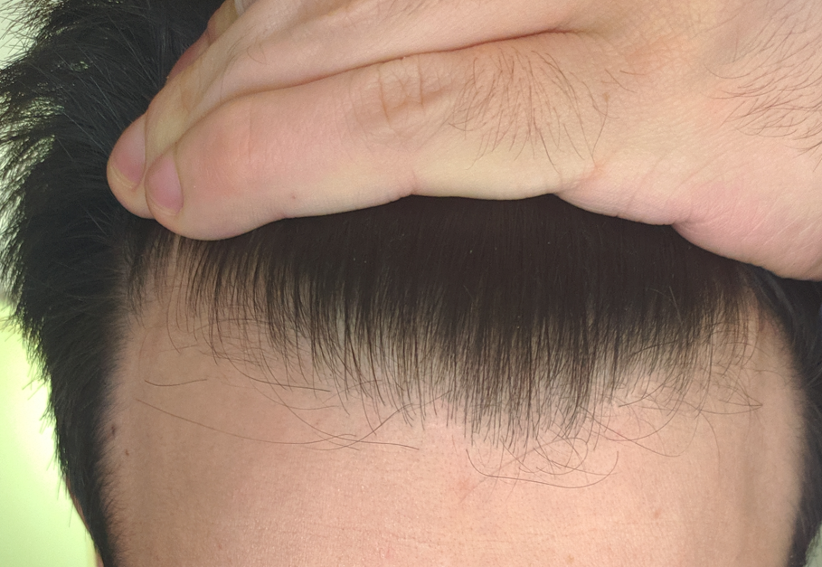 3. 2019 dicembre [stavo assumendo fina da un paio di settimane, per non fermarmi fino a inizio 2022]