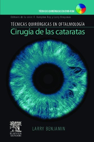 Cirugía de las Cataratas. Técnicas Quirúrgicas en Oftalmología - Larry Benjamin (PDF) [VS]