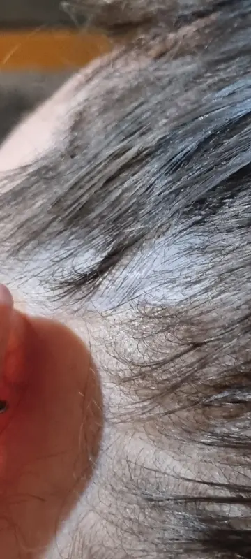 6-years-searching-for-diagnosis-just-found-multiple-v0-p49a9ty21zod1