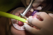 Navigating-Your-Options-for-Wisdom-Teeth-Removal-in-Sydney