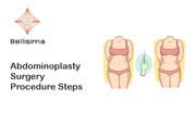 abdominoplasty surgery