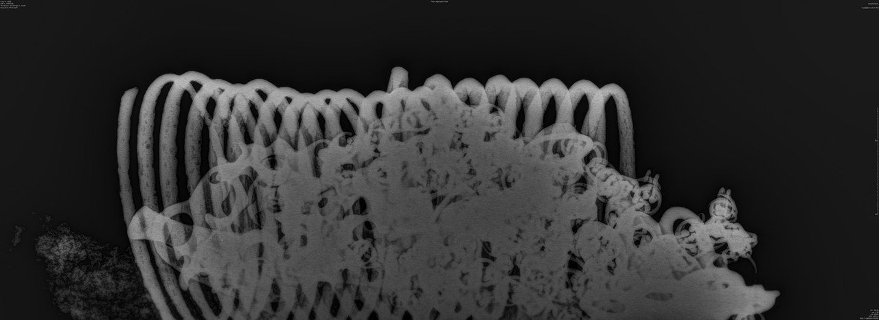 Röntgen KM42755 (RR1)
