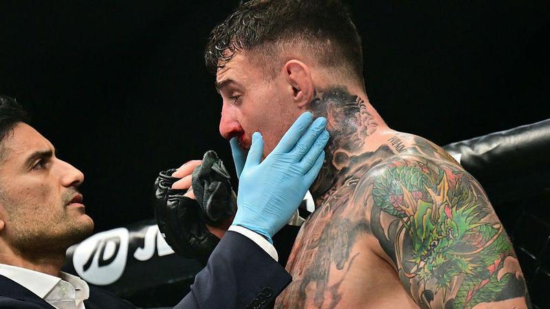 ММА реферите ще бъдат по-строги към бърканията в очите