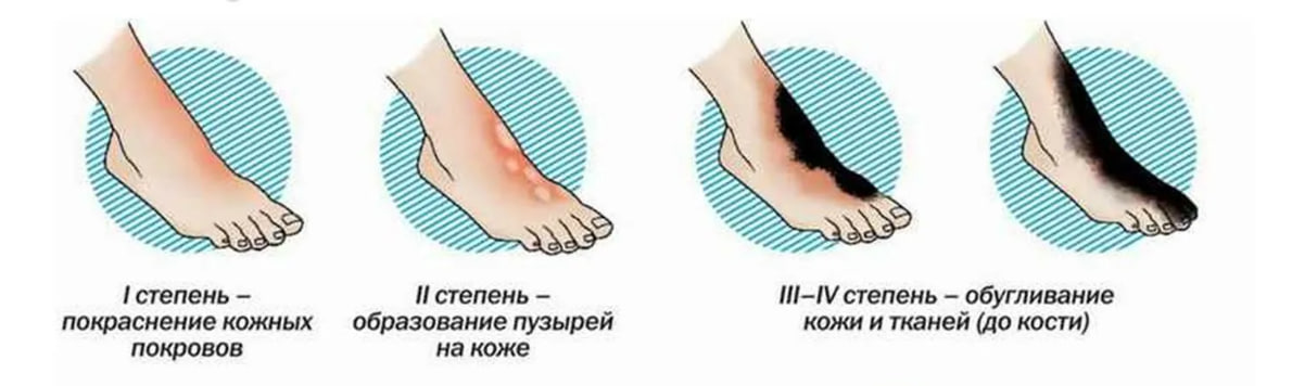 Vidy-ozogov.jpg