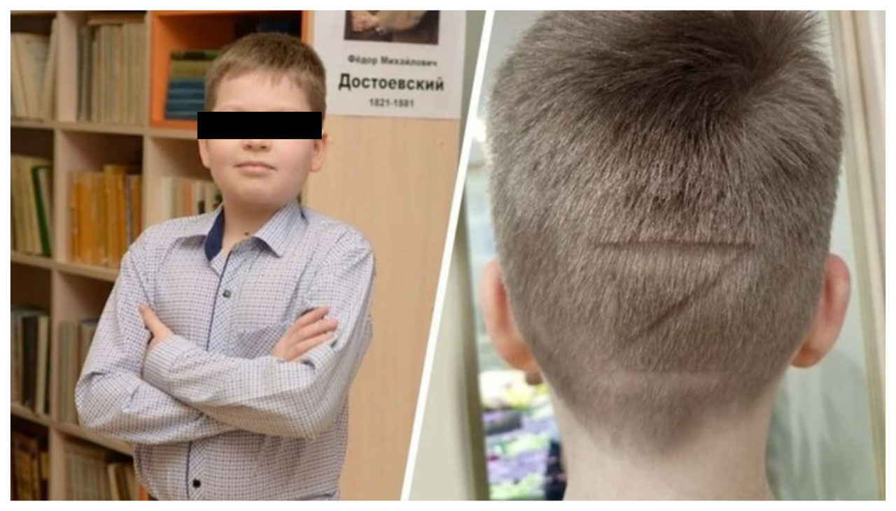 En Rusia, una madre “marcó” a su hijo con la letra Z para apoyar al ejército