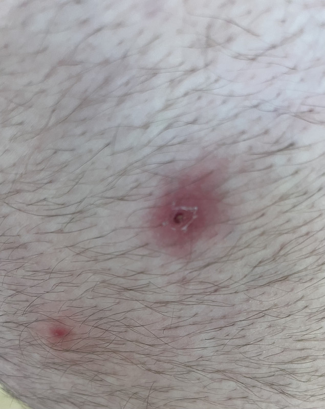 981AC431-C8B8-46ED-B5C8-AD37B31FB67D