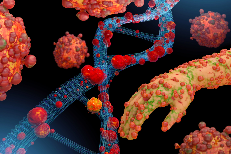 Texas reporta muerte de un paciente con viruela del mono, la primera en EEUU