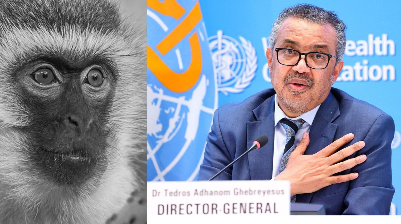 ¿Cuántos casos de viruela del mono hay en el mundo?