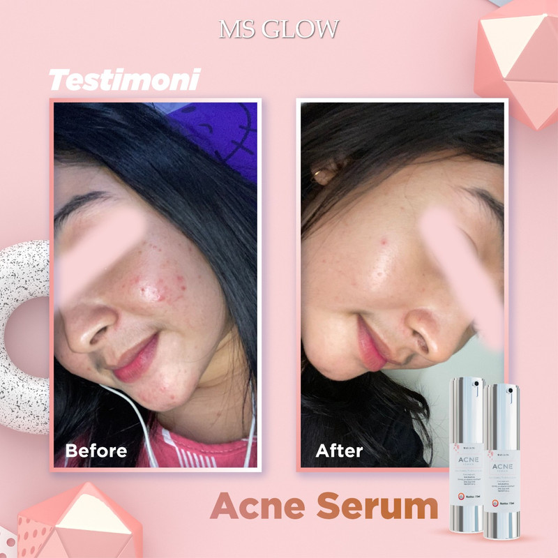 testimoni ms glow skin care