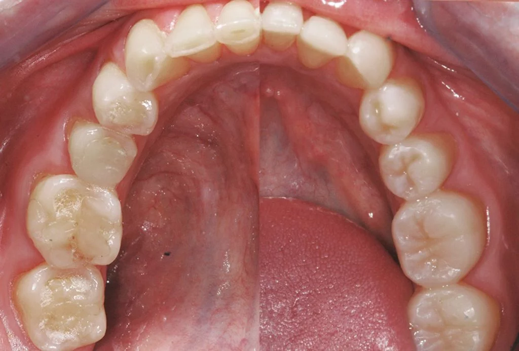 [Imagen: odontolog-a-restauradora-2-1024x693.png]