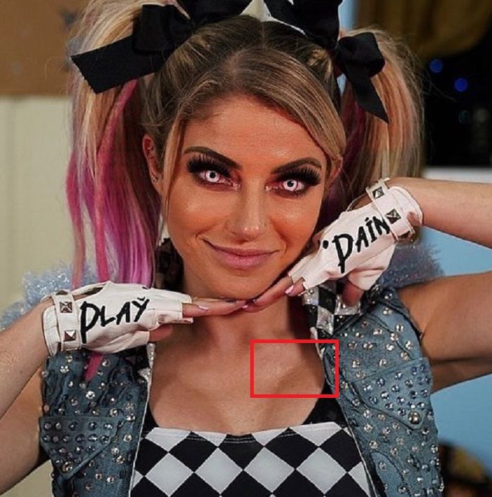 Left-Pec-Alexa-Bliss