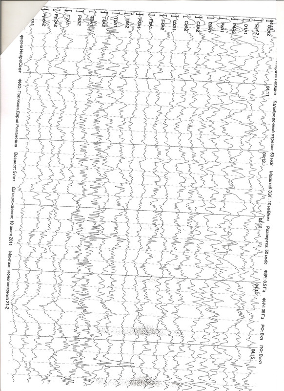 сканирование0014