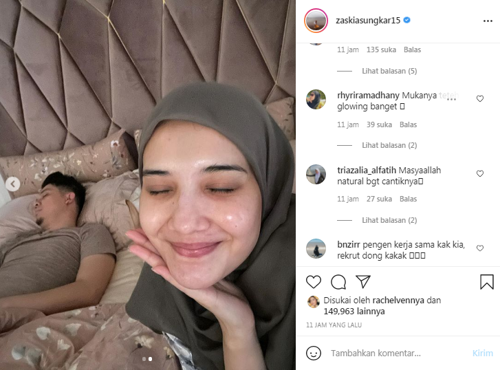 Zaskia Sungkar pamer wajah bare face yang tetap glowing