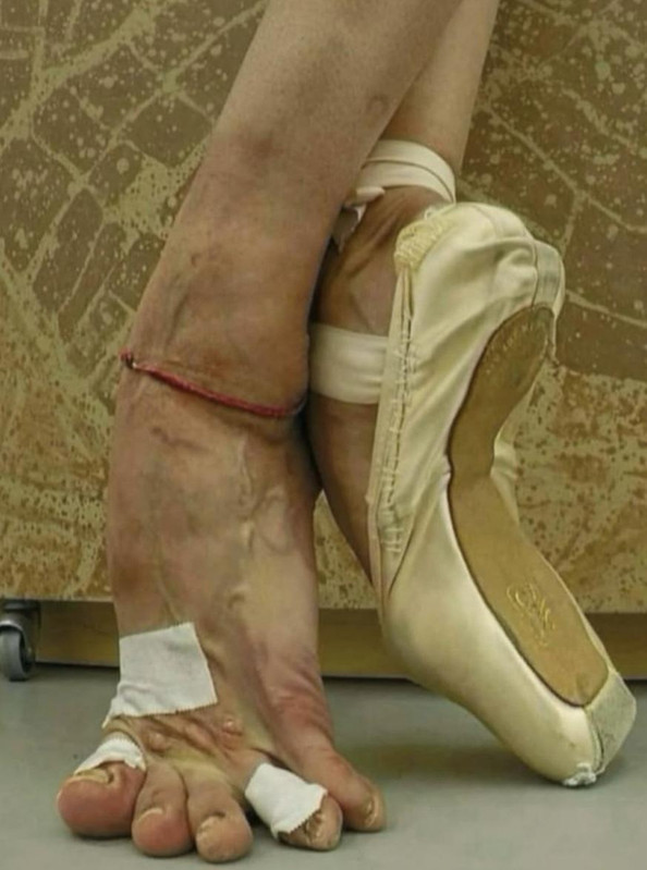 ballerina-feet