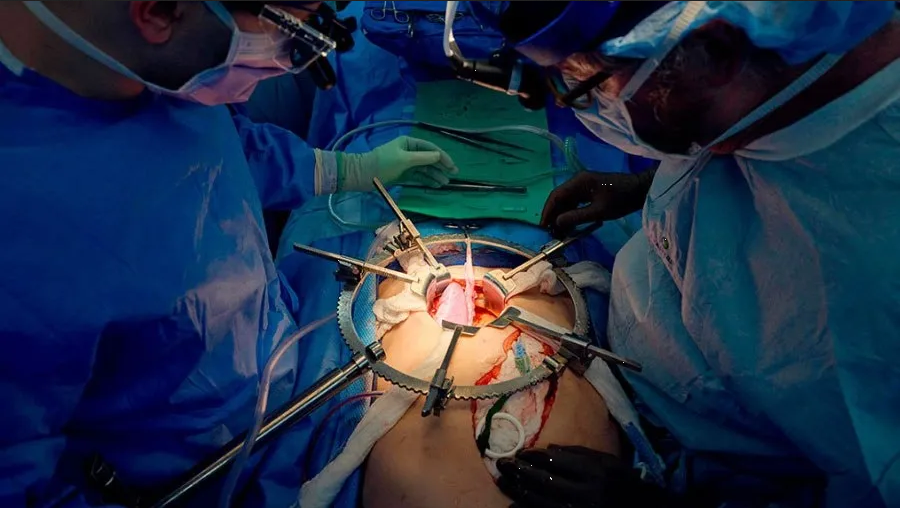 Los científicos celebran que el riñón de cerdo sigue funcionando en el cuerpo humano