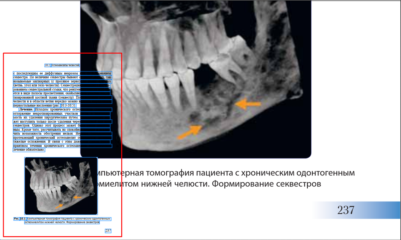 qehEsjfSQvSumsT69VjdDA