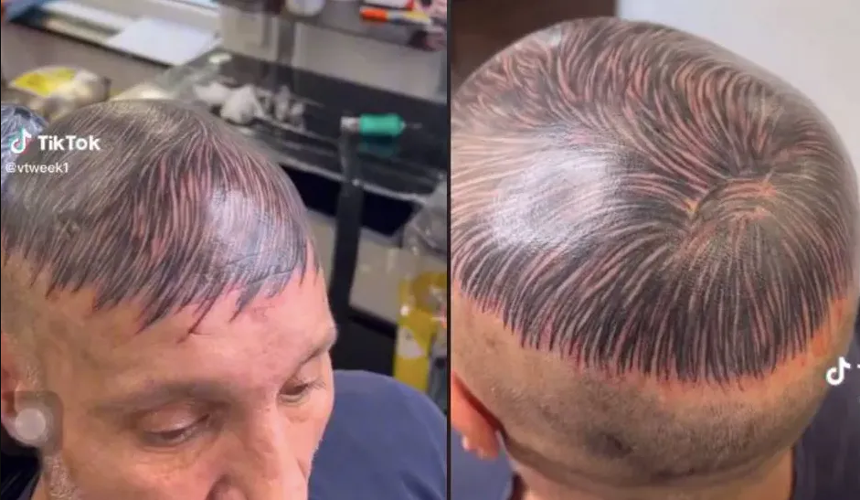 Este sujeto se tatúa la cabeza para ocultar calvicie y resultado se hace viral