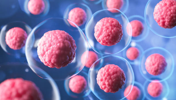 Parkinson’s stem cell therapy Mexico