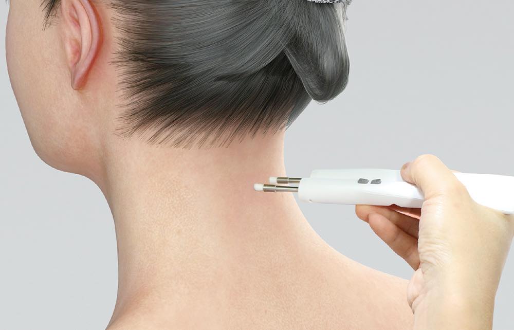 急性スポーツ外傷