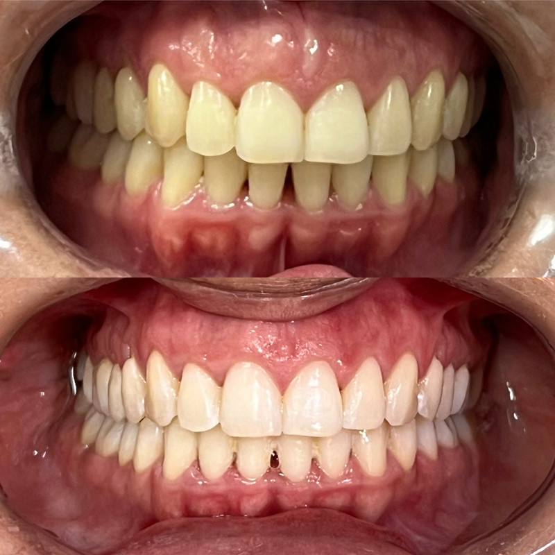Resultado clínico 04