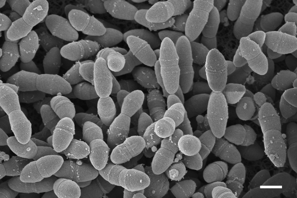 Streptococcus-Pneumoniae.jpg