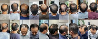 Customer Before and After Hair Transformation