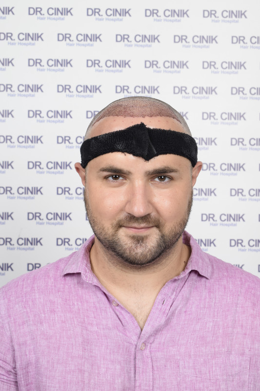 photos postopératoires