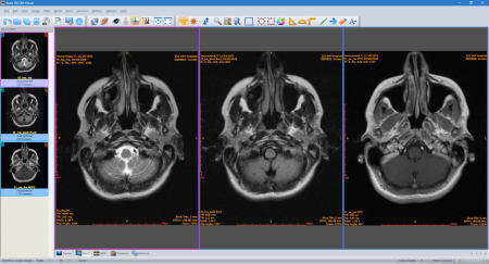 Sante DICOM Viewer Pro 12.1.5