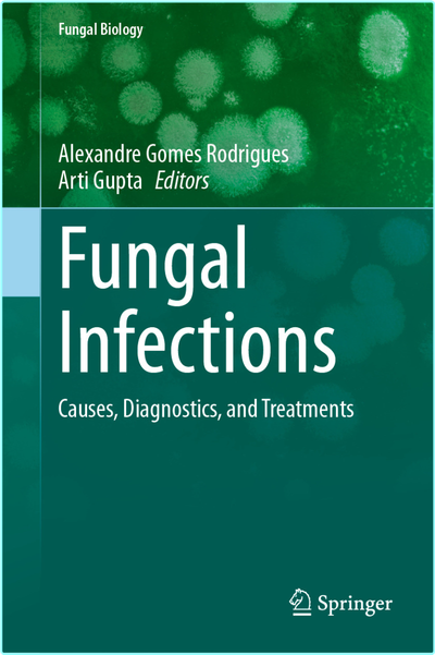Fungal Infections Causes Diagnostics And Treatments (Alexandre Gomes Rodrigues, Arti Gupta)