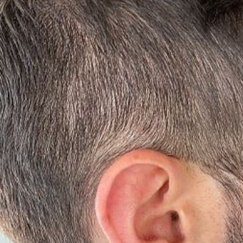 Antes NovaHair