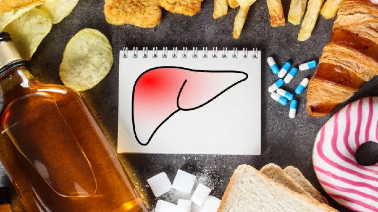 ¿Qué es el hígado graso y cómo evitar tenerlo?