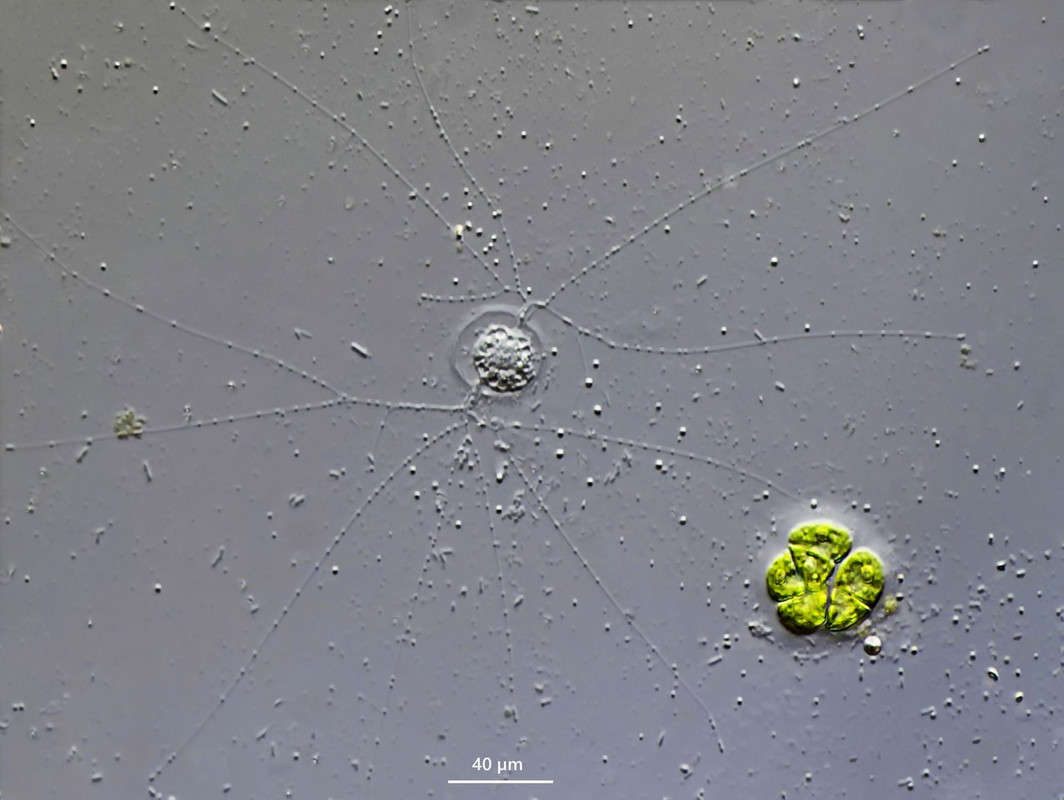 Ditrema 01 longicollis Granofilose Amöbe (2 Öffnungen) DIK 40 D-K-Z7