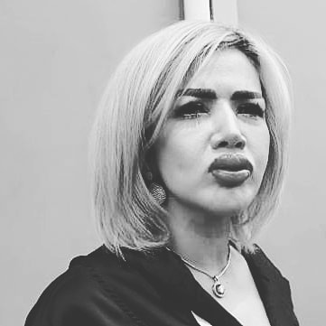 Jalani Operasi Sulam Bibir, Barbie Kumalasari Takut Lihat Dirinya Sendiri : ‘Kaya Joker’.