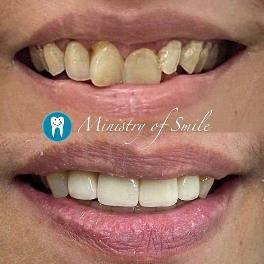 Best dental clinic in Gurgaon (2)