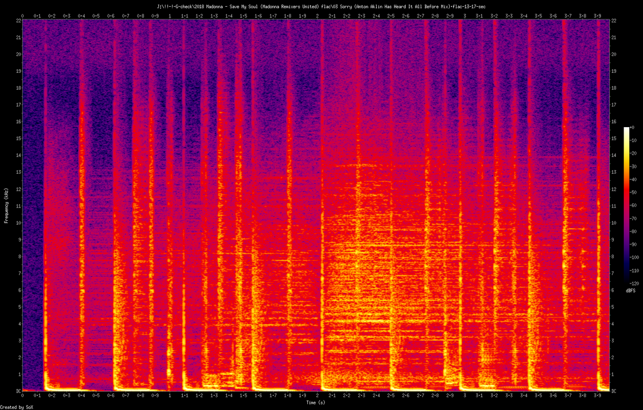 03 Sorry (Anton Aklin Has Heard It All Before Mix).flac-13-17-se