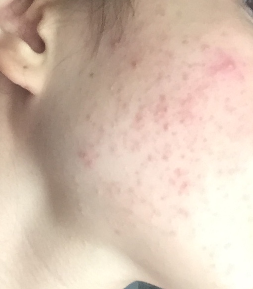 F522CD74-41AF-48F8-BD9D-250D19FFC47D