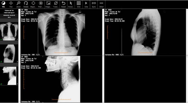 Fujidenolo Solutions SonicDICOM PACS 3.14.0