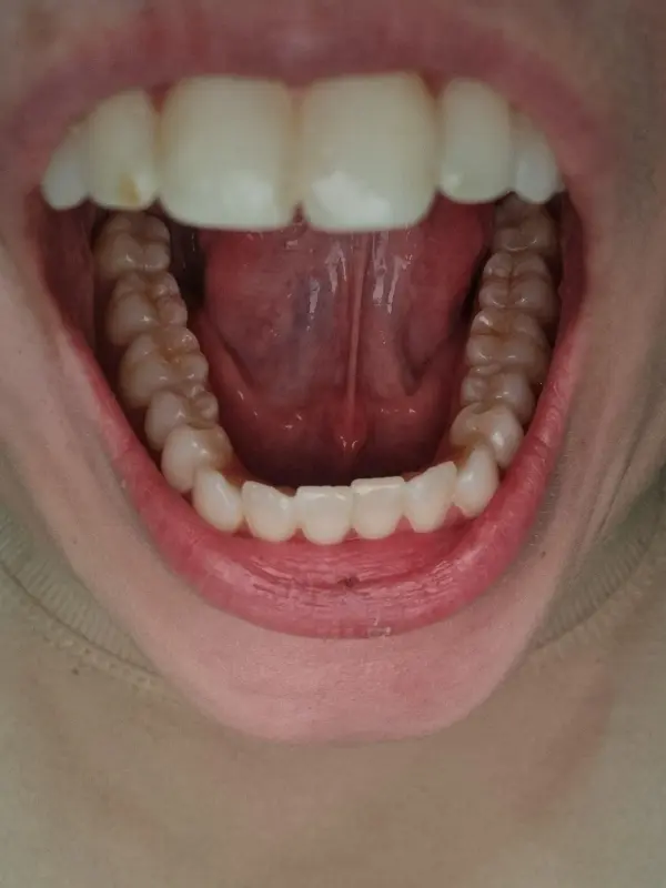 6-years-searching-for-diagnosis-just-found-multiple-v0-t9jjbv91xyod1