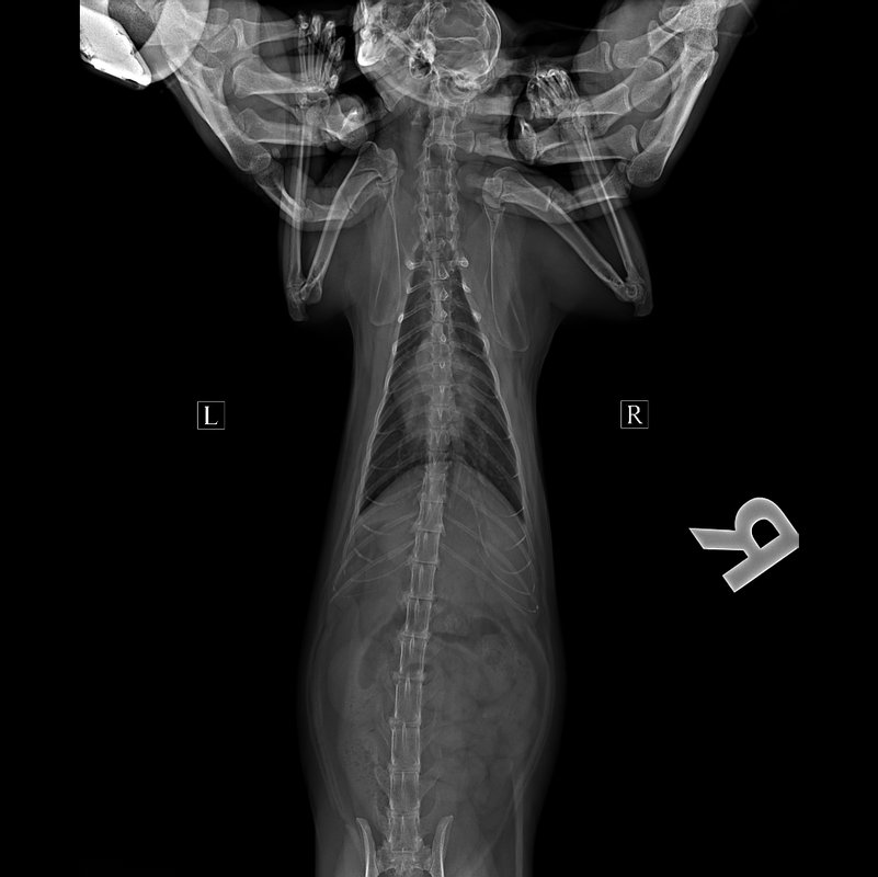 Грудная клетка-ВД