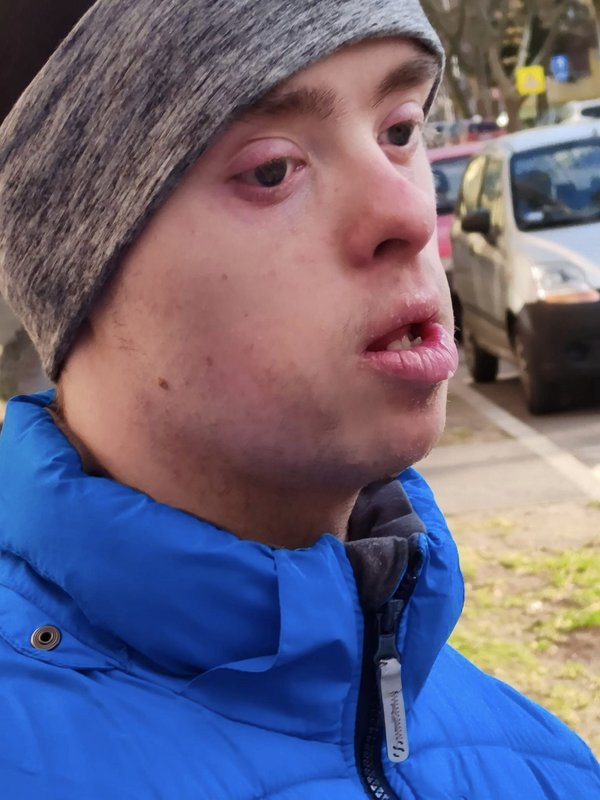 Kép