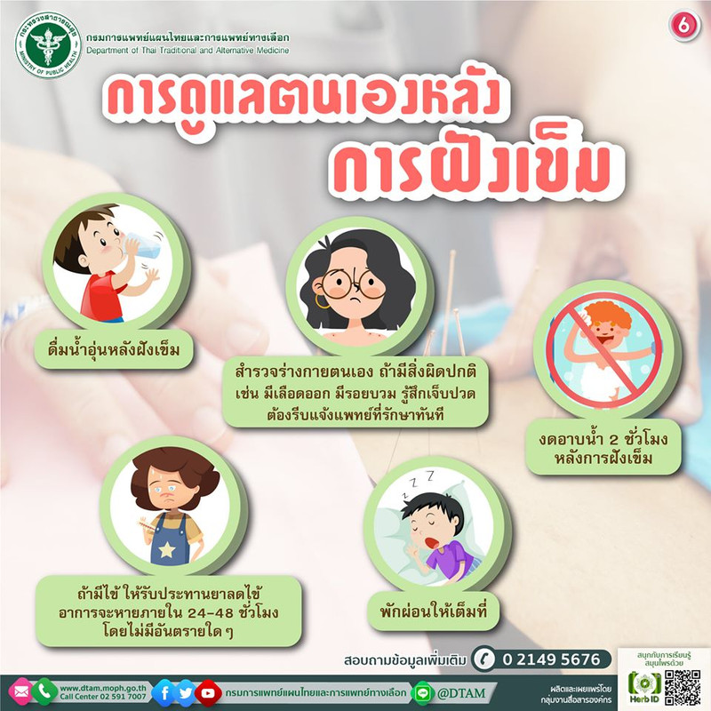 วิธีการดูแลตนเองหลังการฝังเข็ม