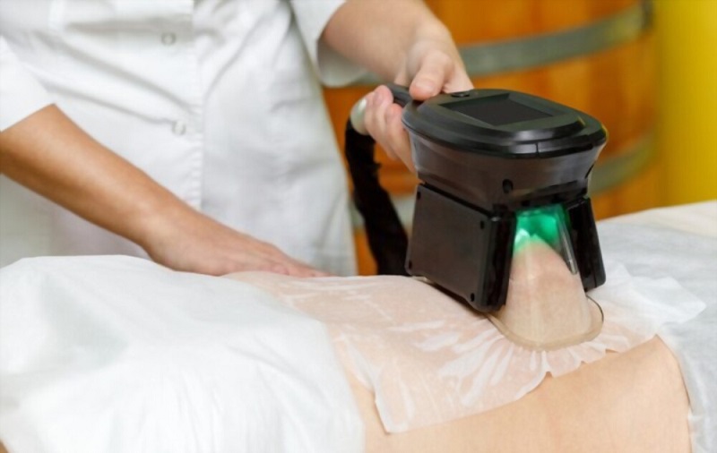 coolsculpting