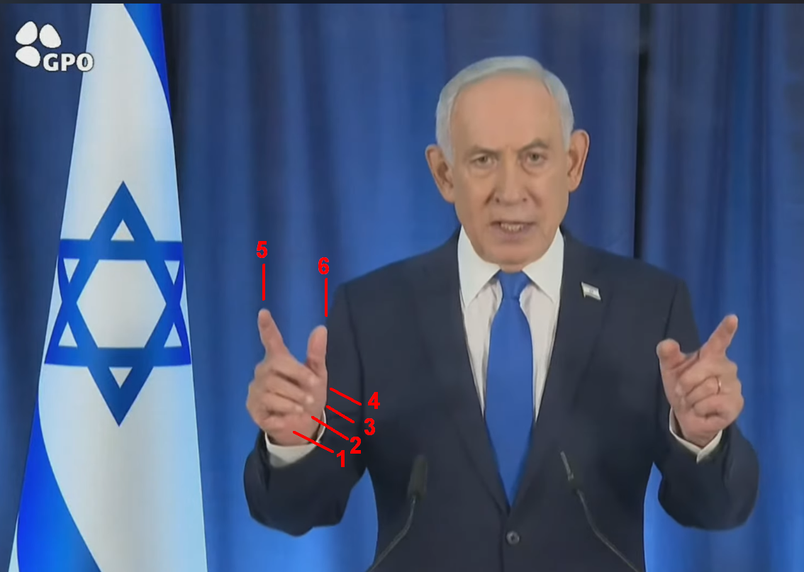Bibi has 6 fingers
