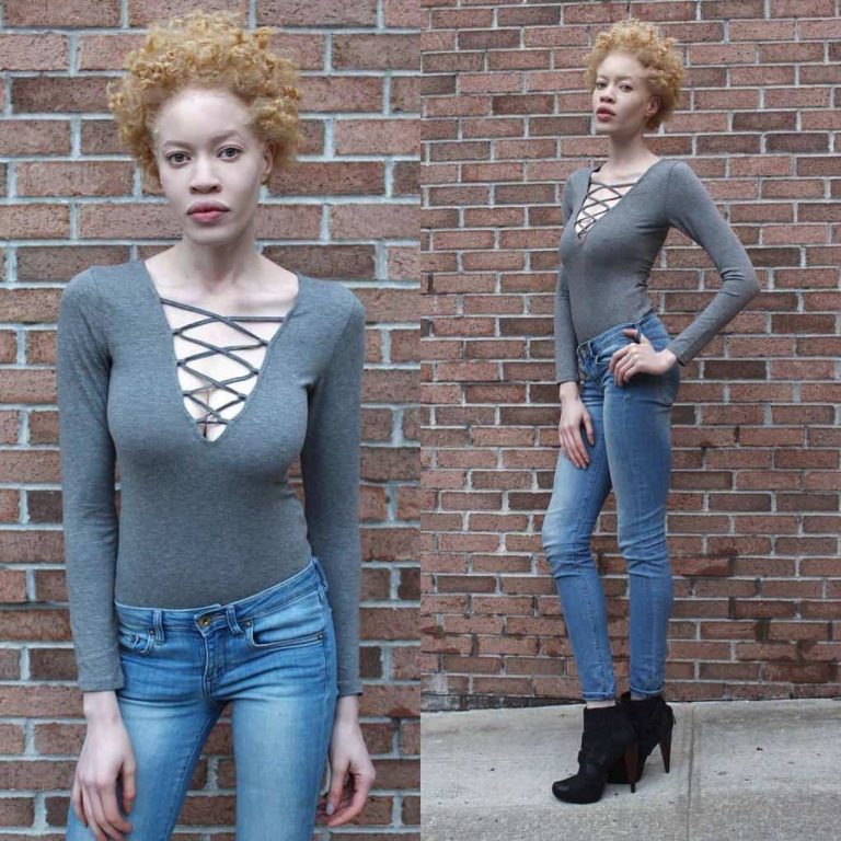 Афроамериканская модель с альбинизмом поразила всех своей необычной внешностью