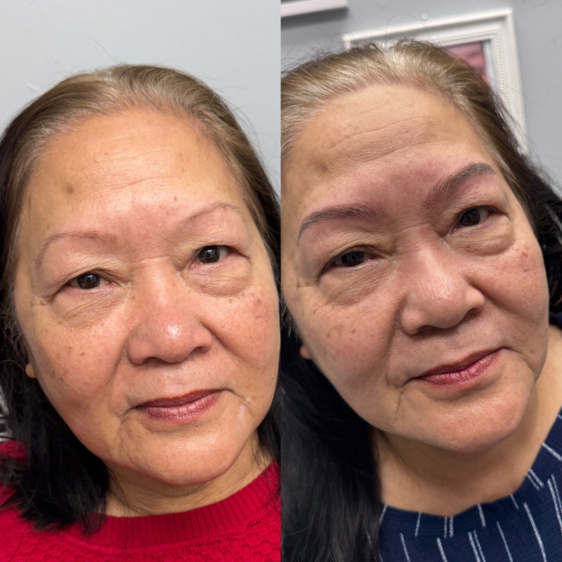 Eyebrow Enhancement Example New 4