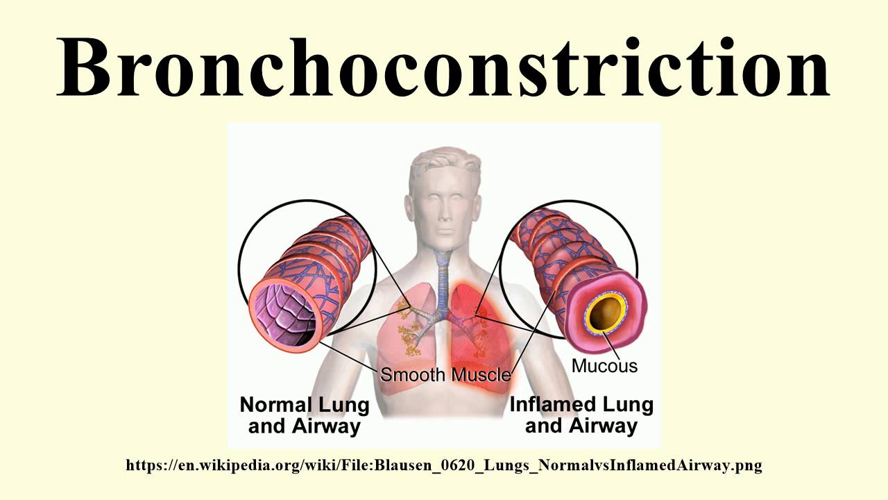 How Leukotrienes Cause Bronchoconstriction