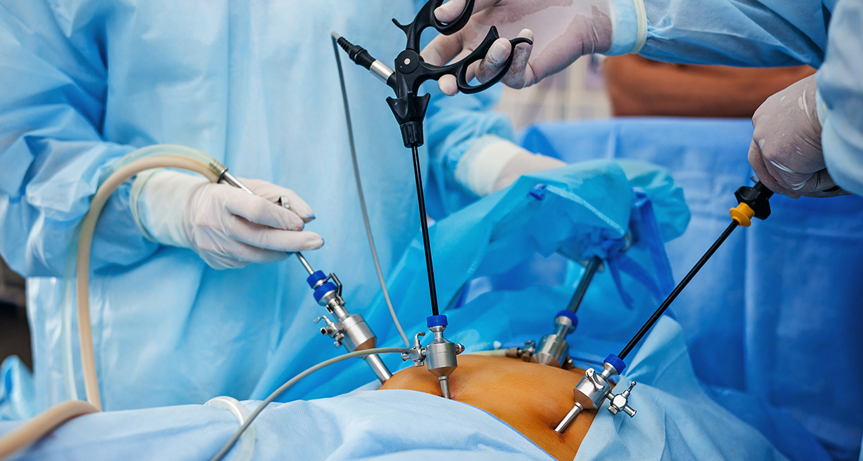 General Surgery — Tura Christian Hospital