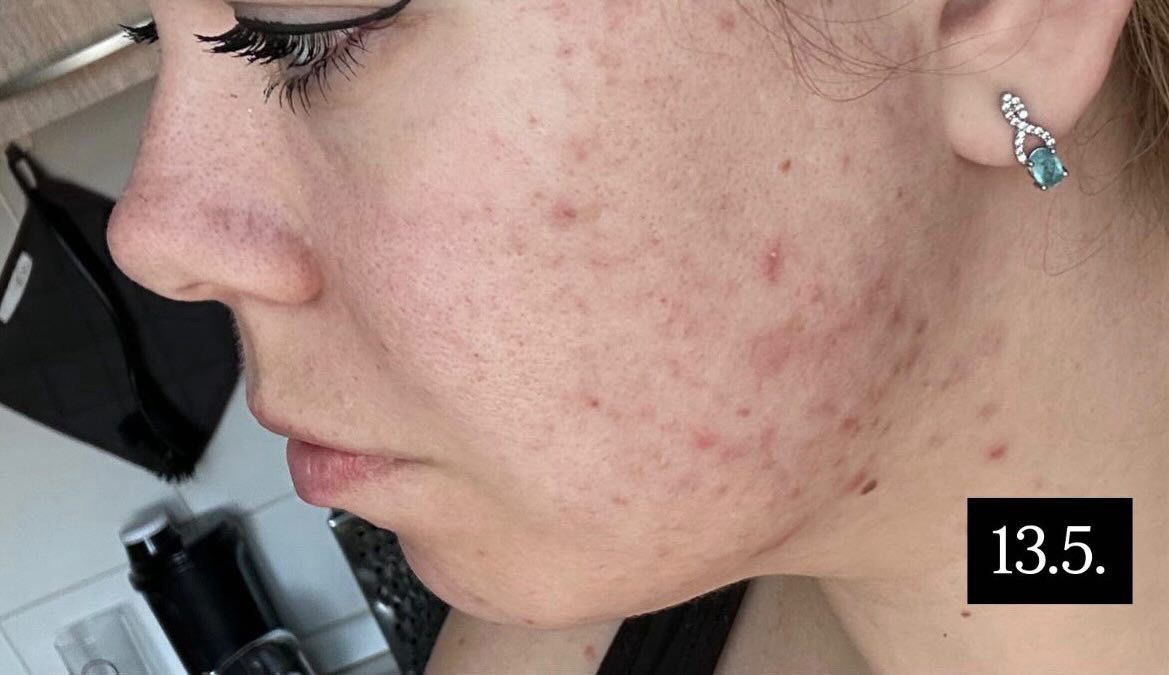 Profesionální kosmetika