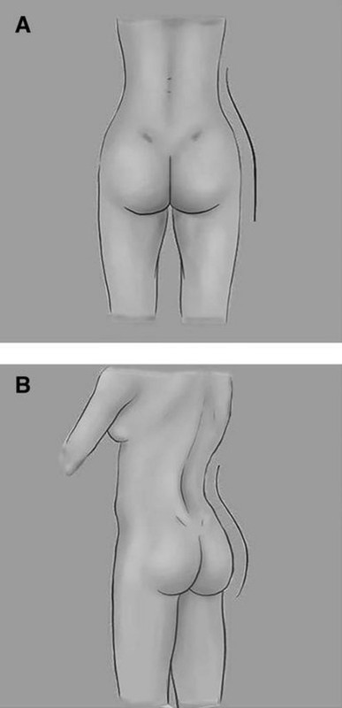 10-1055-s-0042-1749099-i2140992-2