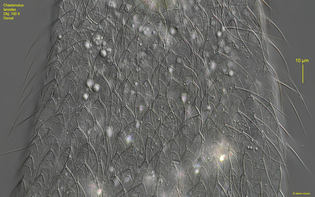 Chaetonotuslaroides-Kopie